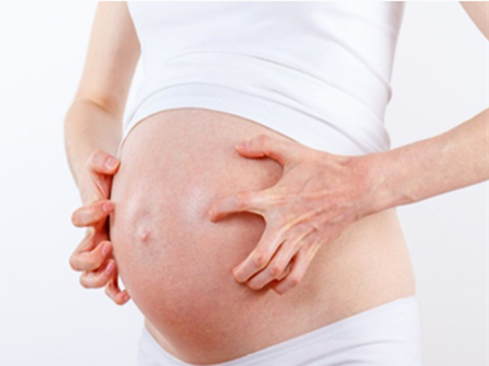 準(zhǔn)媽媽皮膚瘙癢，可適當(dāng)用藥！